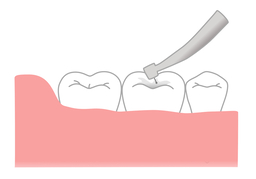 chip offのイラスト
